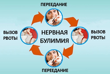 Лечение булимии в Мошково